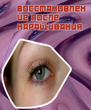 Восстановление ресниц после наращивания